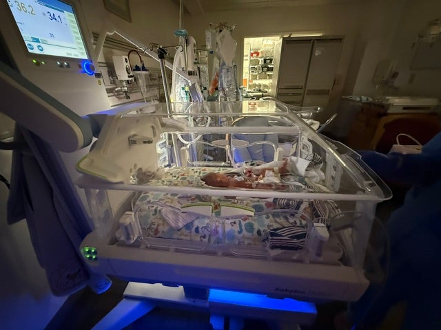 An image of a newborn in an isolette.
