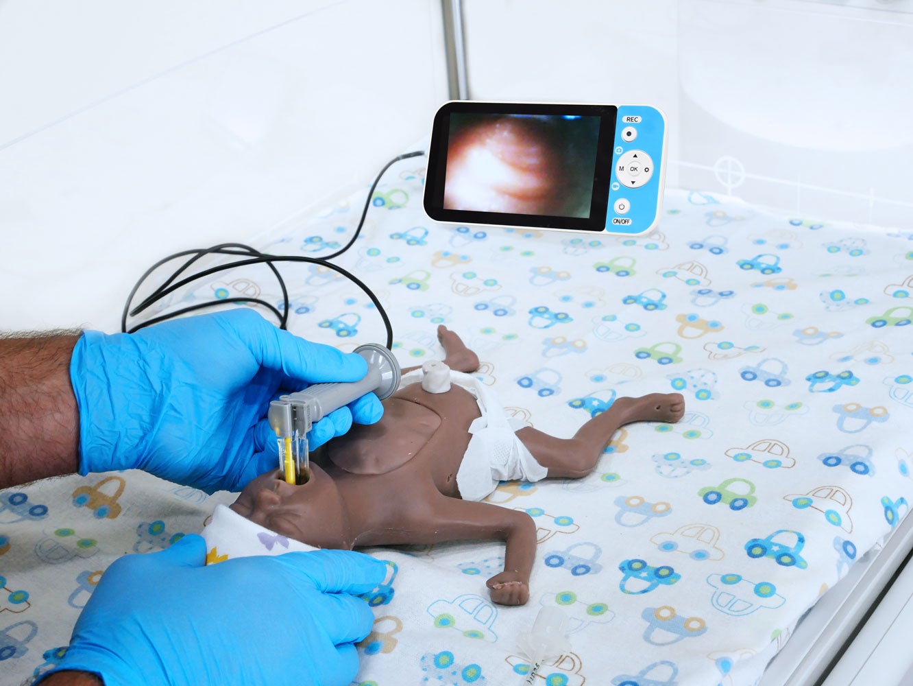 An image showing how the NewView video laryngoscopy system is used on a simulated infant patient.